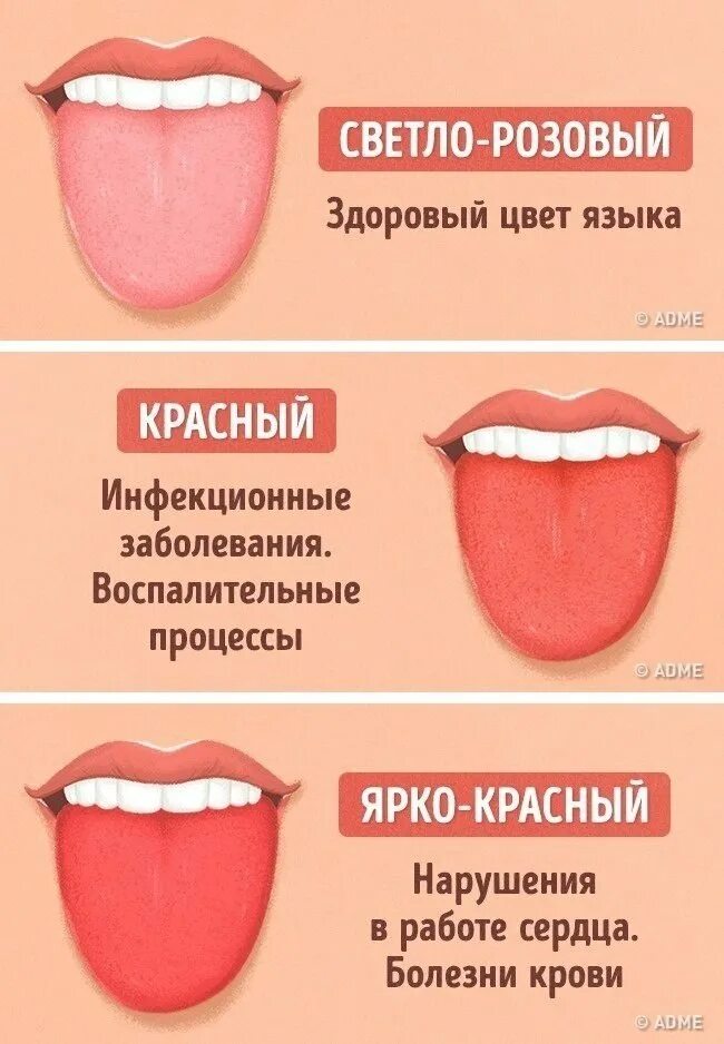 Красный язык причины у взрослого фото 13 проблем, о которых может рассказать цвет языка! Автор: ADME #советы@ican