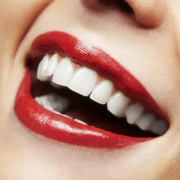 Красный зуб фото teeth whitening northridge Dental whitening, Laser teeth whitening, Teeth whiten