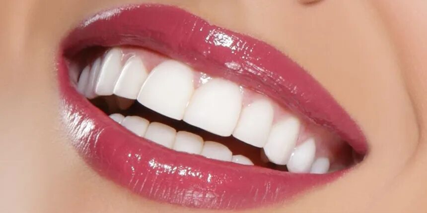 Красный зуб фото Get the hollywood smile from the best dental clinic in Al Barsha, Dubai. #Hollyw
