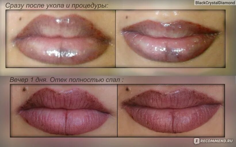 Красят ли губы после перманентного макияжа Татуаж губ - "Забудьте о помадах! Раз и навсегда!))" отзывы