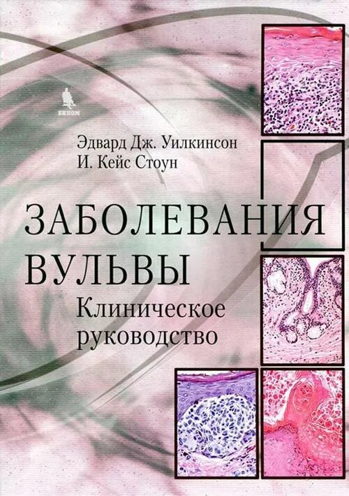 Крауроз у женщин фото симптомы лечение Заболевания вульвы. Атлас. Руководство - купить в Москве, цены в интернет-магази