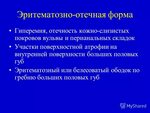 Крауроз у женщин фото симптомы лечение Крауроз лечение мази