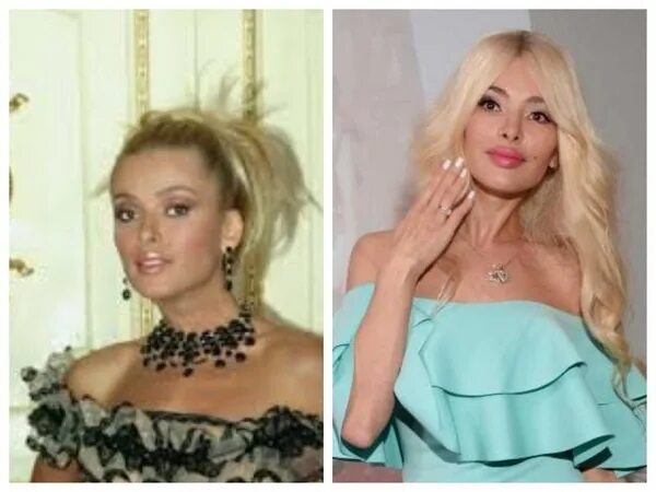 Кравец до пластики фото Alena Kravets. Photos before and after plastic surgery, hot, biography, personal
