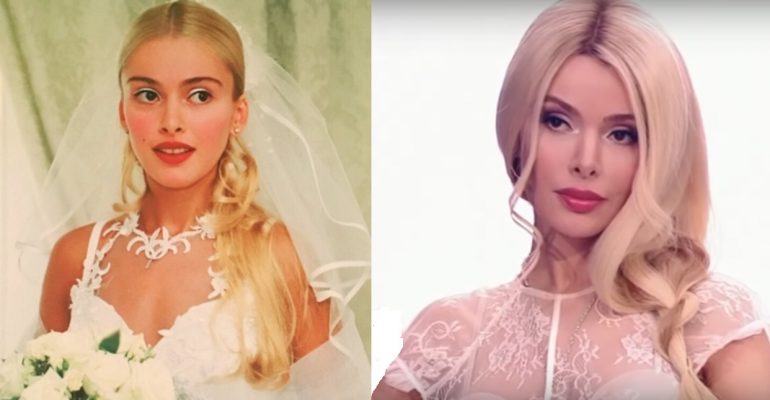 Кравец до пластики фото Как менялась Алена Кравец. Скандалы и личная жизнь - Рамблер/женский