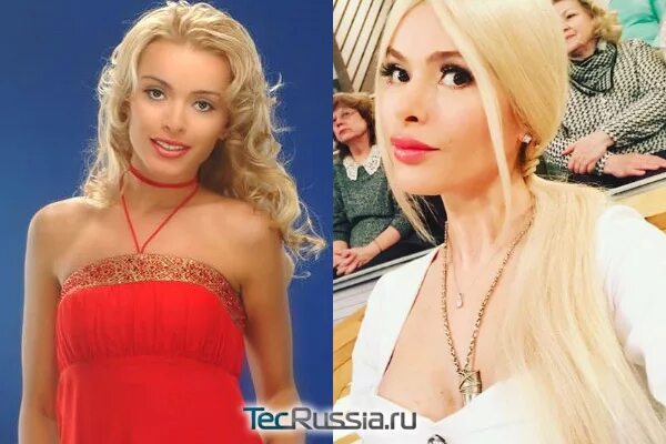 Кравец до пластики фото Алена Кравец до и после пластики - фото и результаты операций