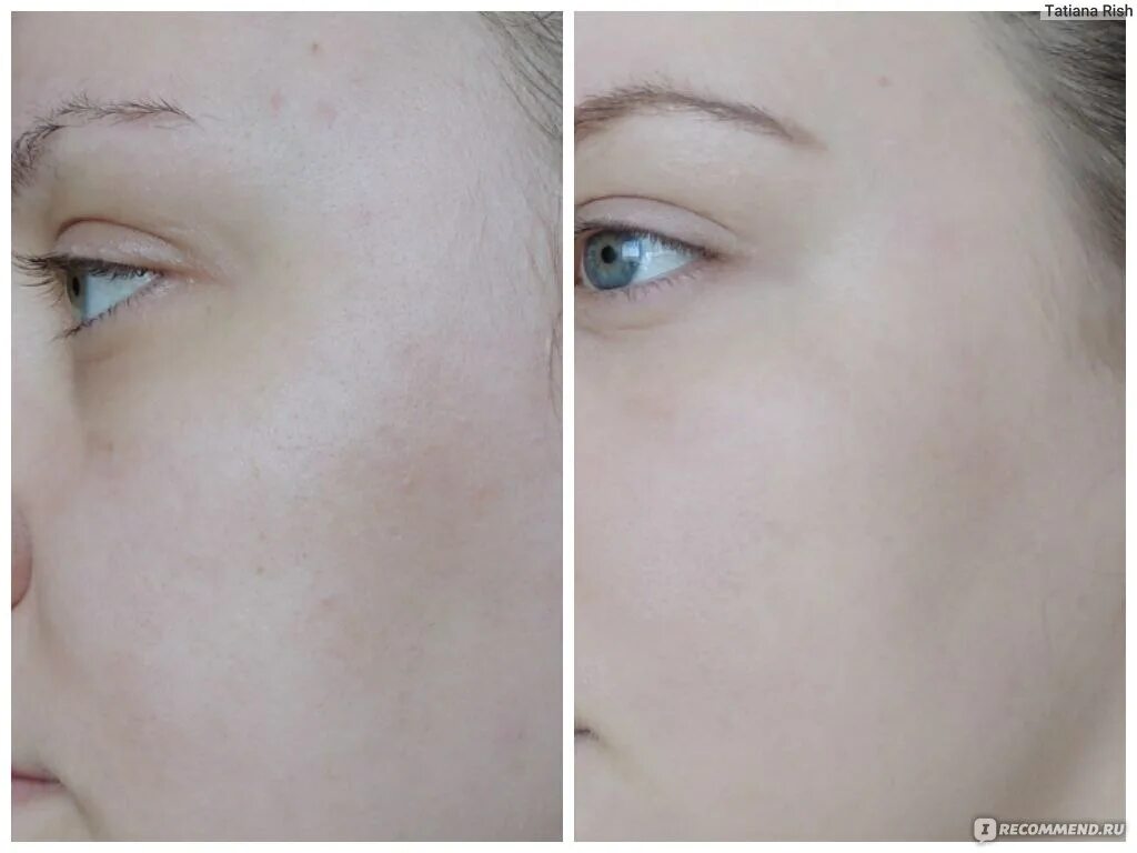 Крем до и после фото CC Cream Mizon Correct Combo (Radiance Skin) - "Мой первый СС крем, и такое удач