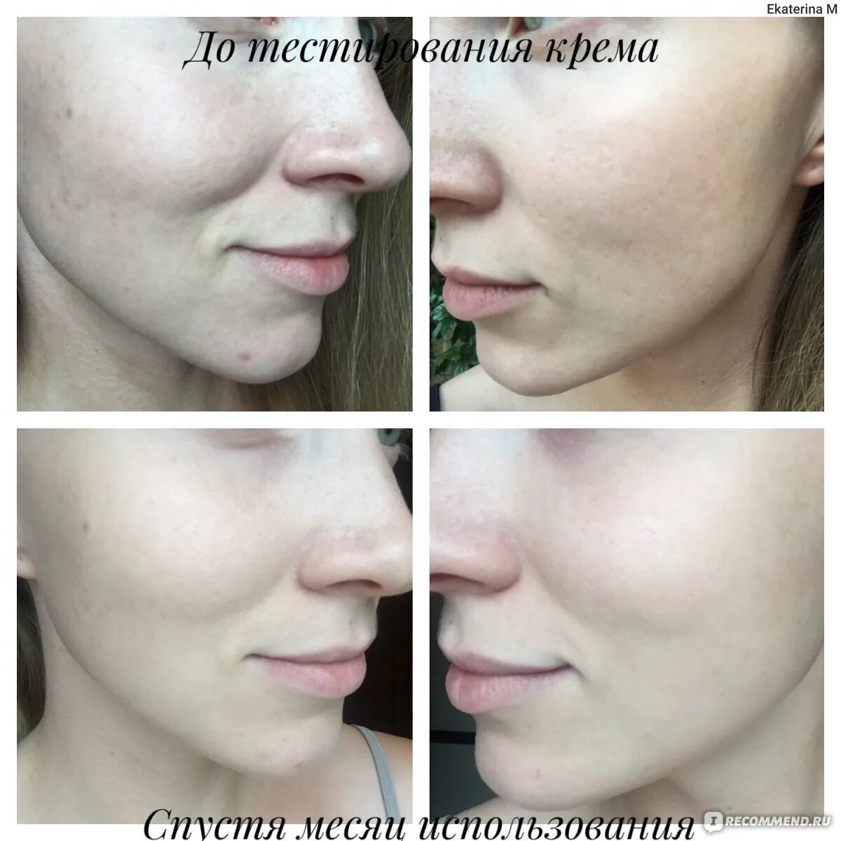 Крем до и после фото Увлажняющий крем для лица Riche Moisture Creme - "Тотальное увлажнение и питание