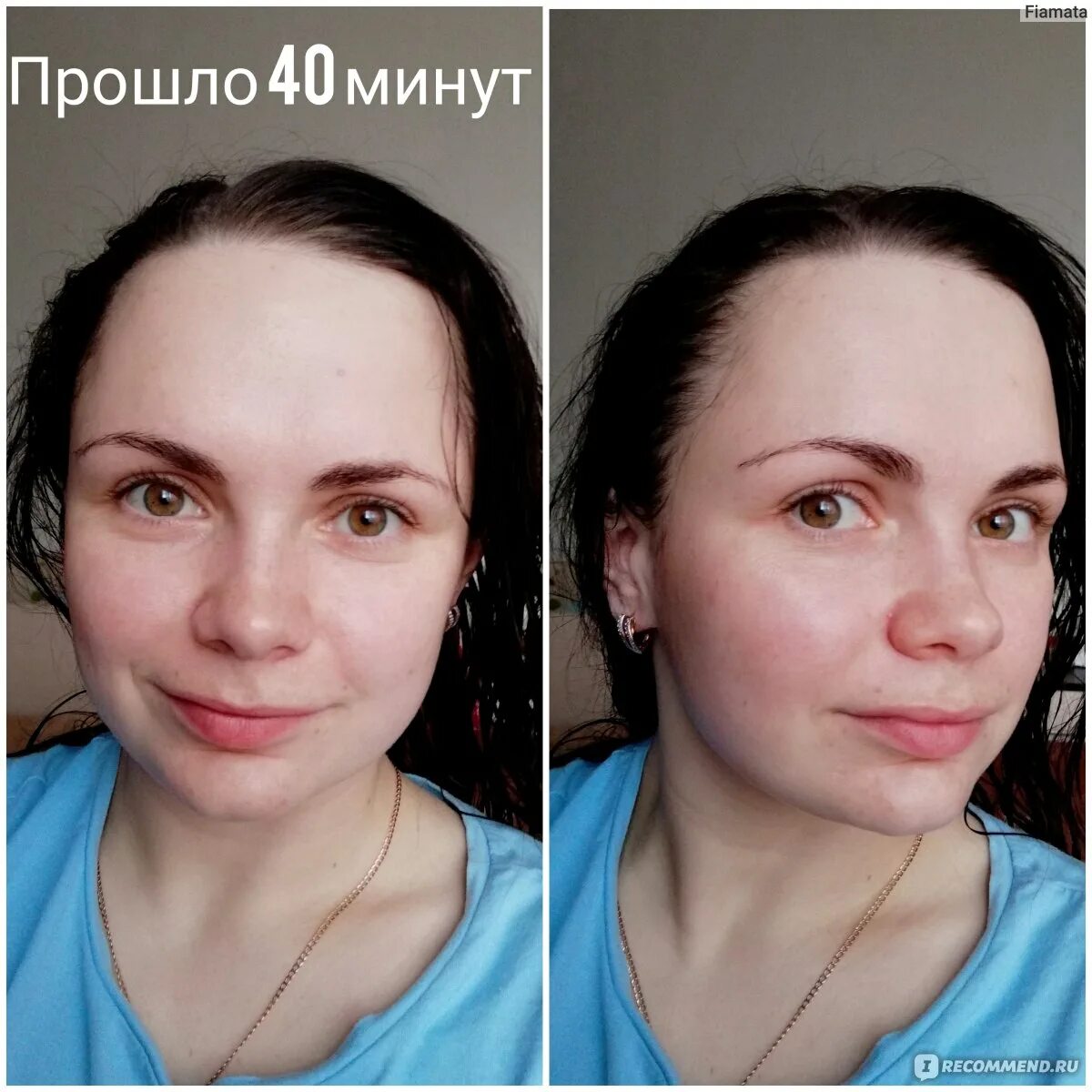 Крем до и после фото Крем дневной для лица Belkosmex / Белкосмекс Hialurón active интенсивное увлажне