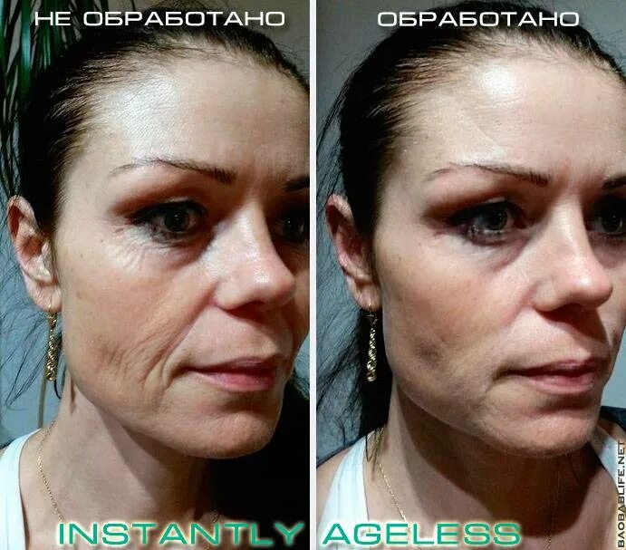 Крем до и после фото применения Крем instantly ageless- применение, эффект, цена, реальные отзывы