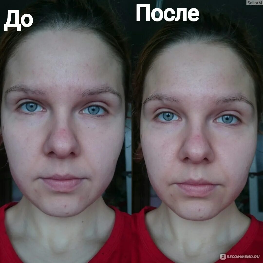 Крем до и после фото применения Сыворотка для лица RICHE Интенсивное увлажнение - "Матовая кожа после масел??? К