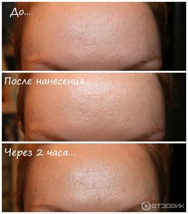 Крем до и после фото применения До и после крем отзывы фото: найдено 89 картинок