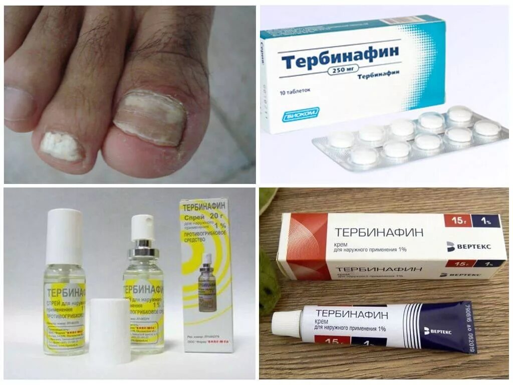 Крем от грибка ног фото Грибок ногтя на ноге лечение недорого: найдено 71 картинок