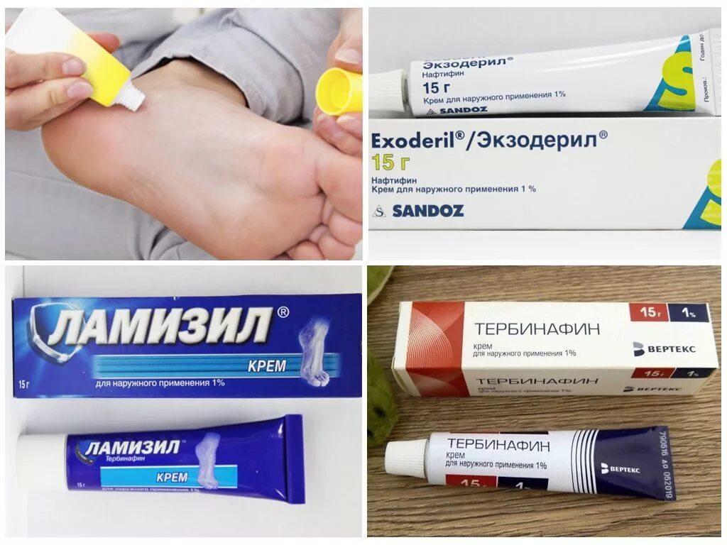 Крем от грибка ног фото Грибок между ног какая мазь