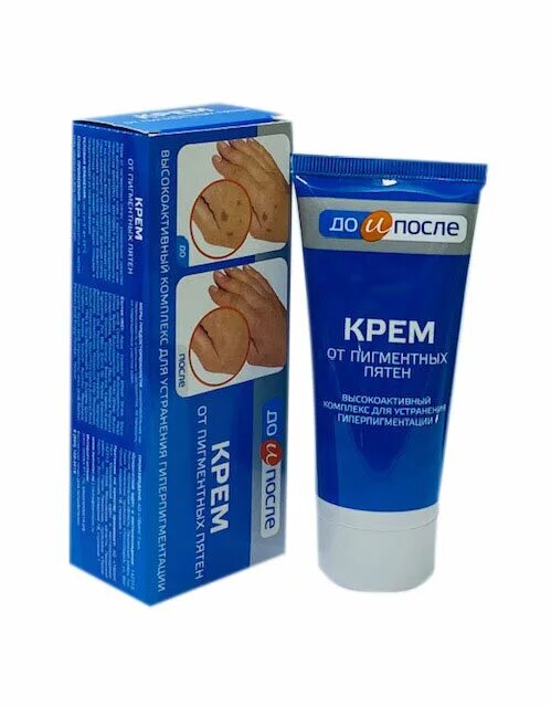Крем от пигментных пятен фото До и После: От пигментных пятен крем (50 мл) от 235 руб. с доставкой по Москве и