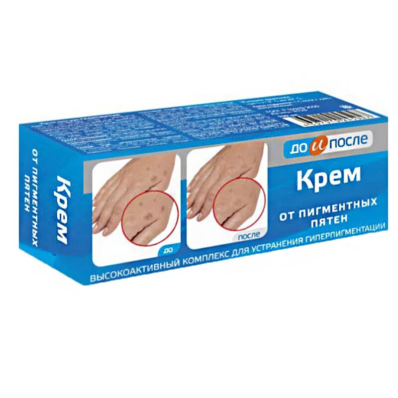 Крем от пигментных пятен отзывы фото ДО И ПОСЛЕ крем от пигментных пятен 50мл купить в Тольятти. Цена до 224.00 ₽