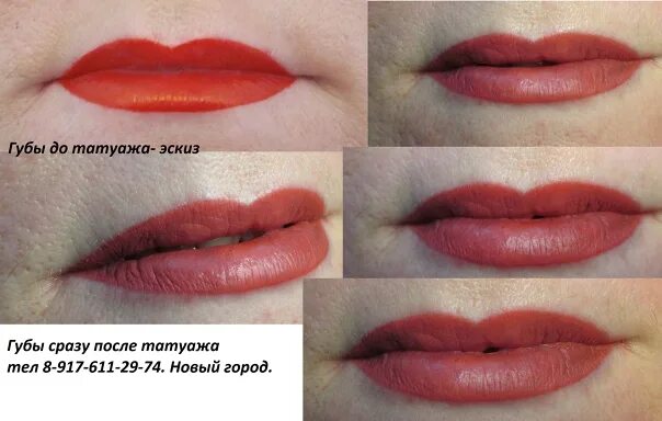 Крем после перманентного макияжа губ Татуаж губ сразу после. Фотография из альбома Без названия - 42 из 46 ВКонтакте