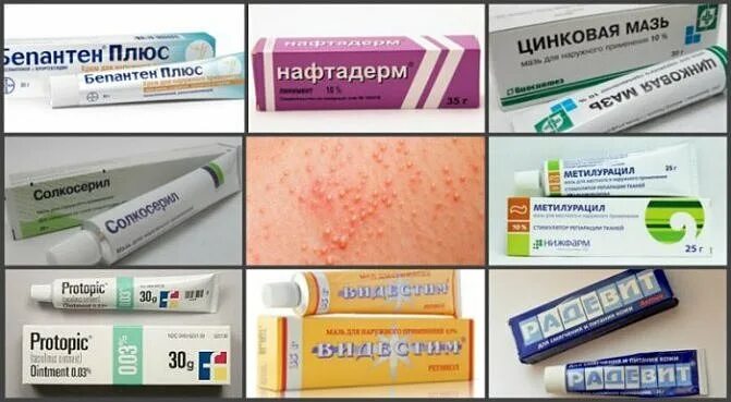 Крема от дерматита фото Мази и крема от дерматита: цены, отзывы, выбор эффективного средства