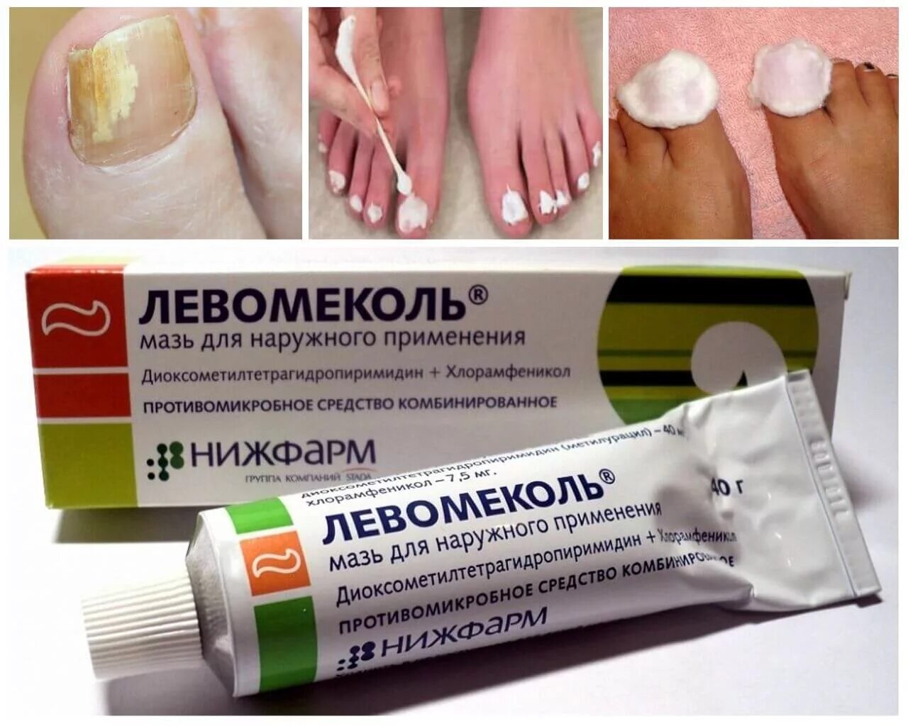 Крема от грибка фото Мазь от грибка ногтей - преимущества, как наносить, ТОП-5 препаратов