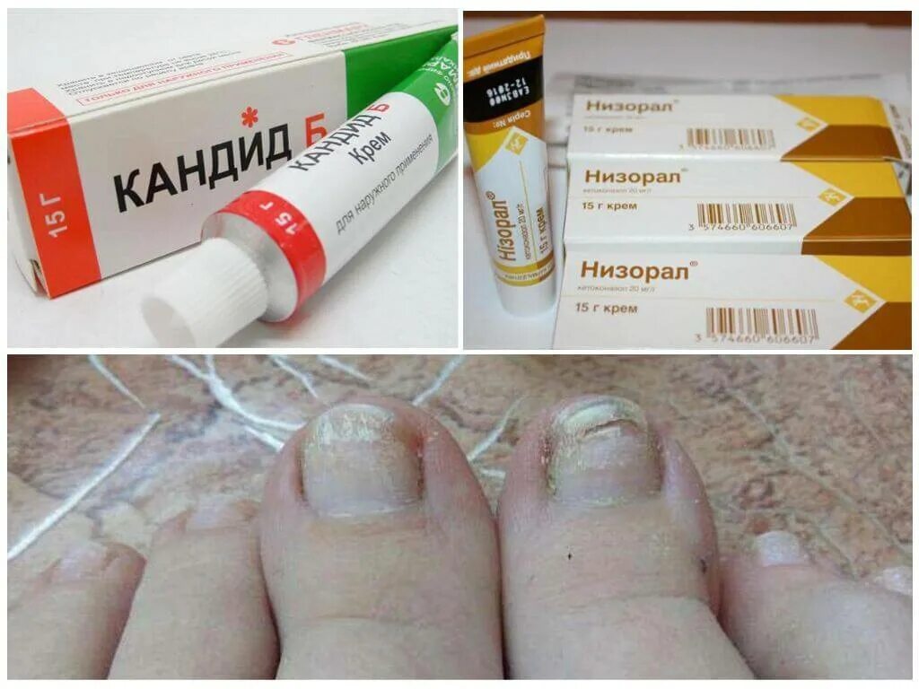 Крема от грибка фото Лучший крем от грибка