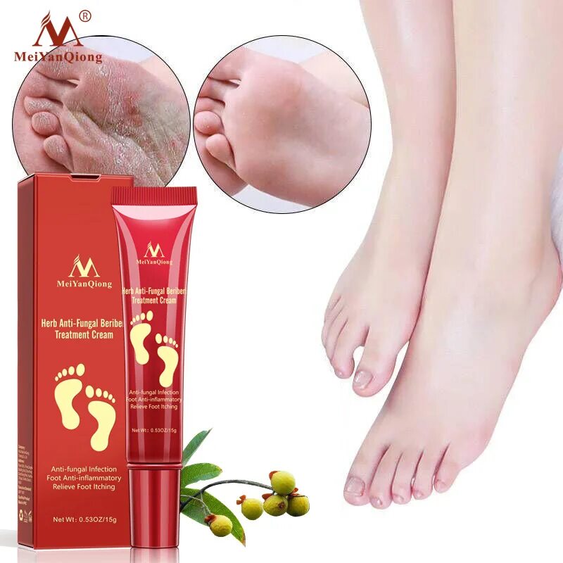 Крема от грибка фото Foot Treatment Herbal Anti Fungal Infection Onychomycosis Paronychia Effective T