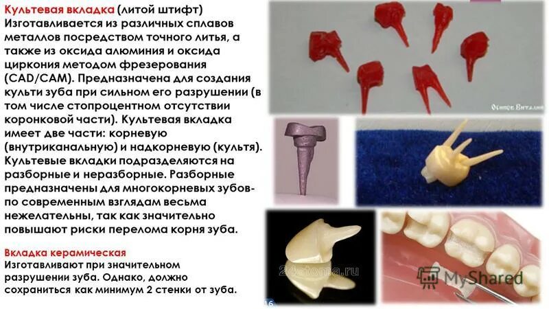 Культевая вкладка зуба фото Картинки ШТИФТОВЫЕ КУЛЬТЕВЫЕ ВКЛАДКИ КЛИНИКО ЛАБОРАТОРНЫЕ ЭТАПЫ