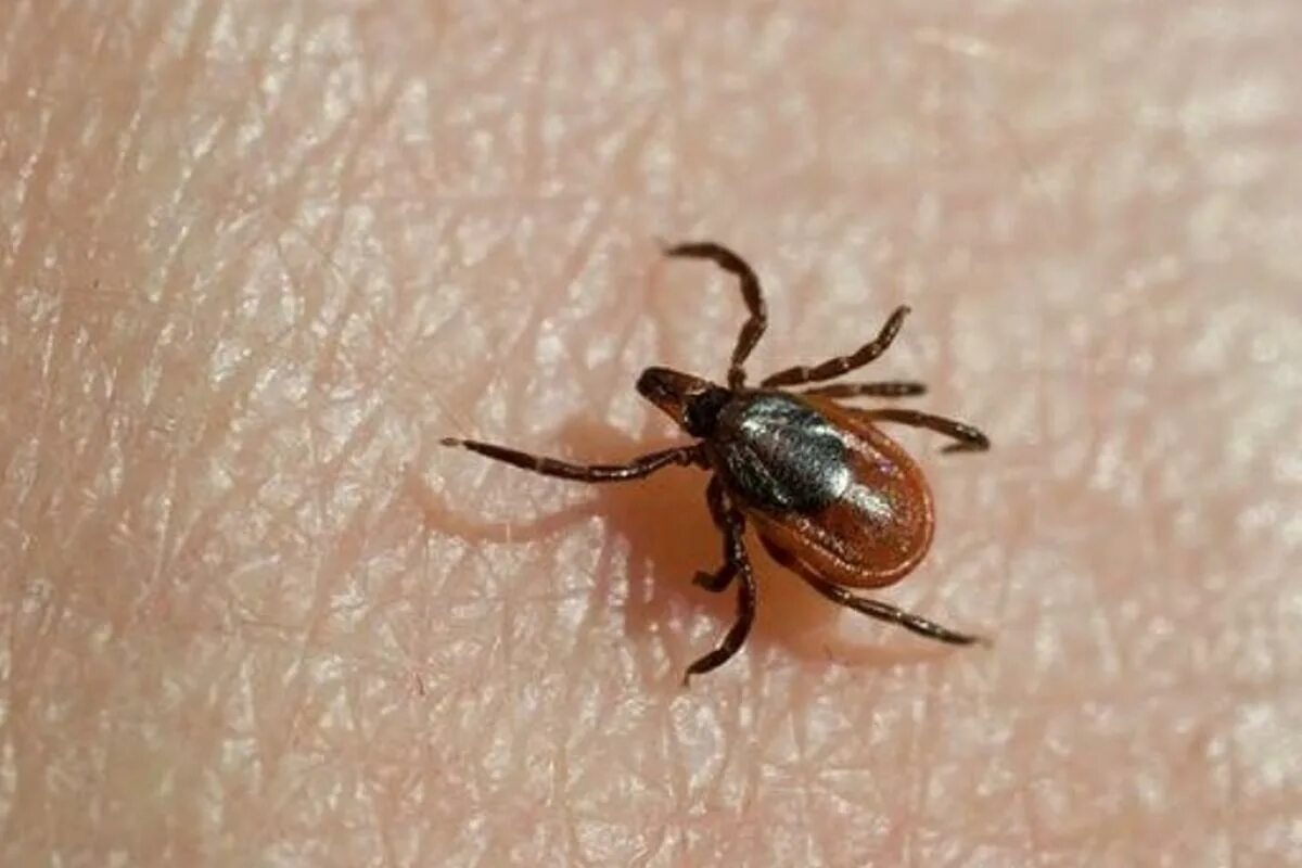 Лесной клещ фото в натуральную величину Medical Microbiology and Infectious Diseases (MSc) Explore UM University of Mani