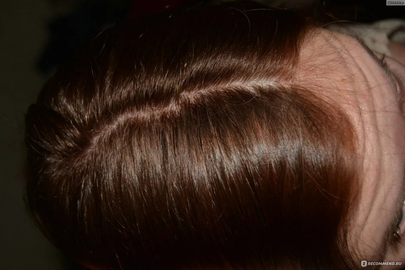 Лесной орех фото волос эстель Краска для волос Schwarzkopf Perfect Mousse - "Мой первый опыт окрашивания волос