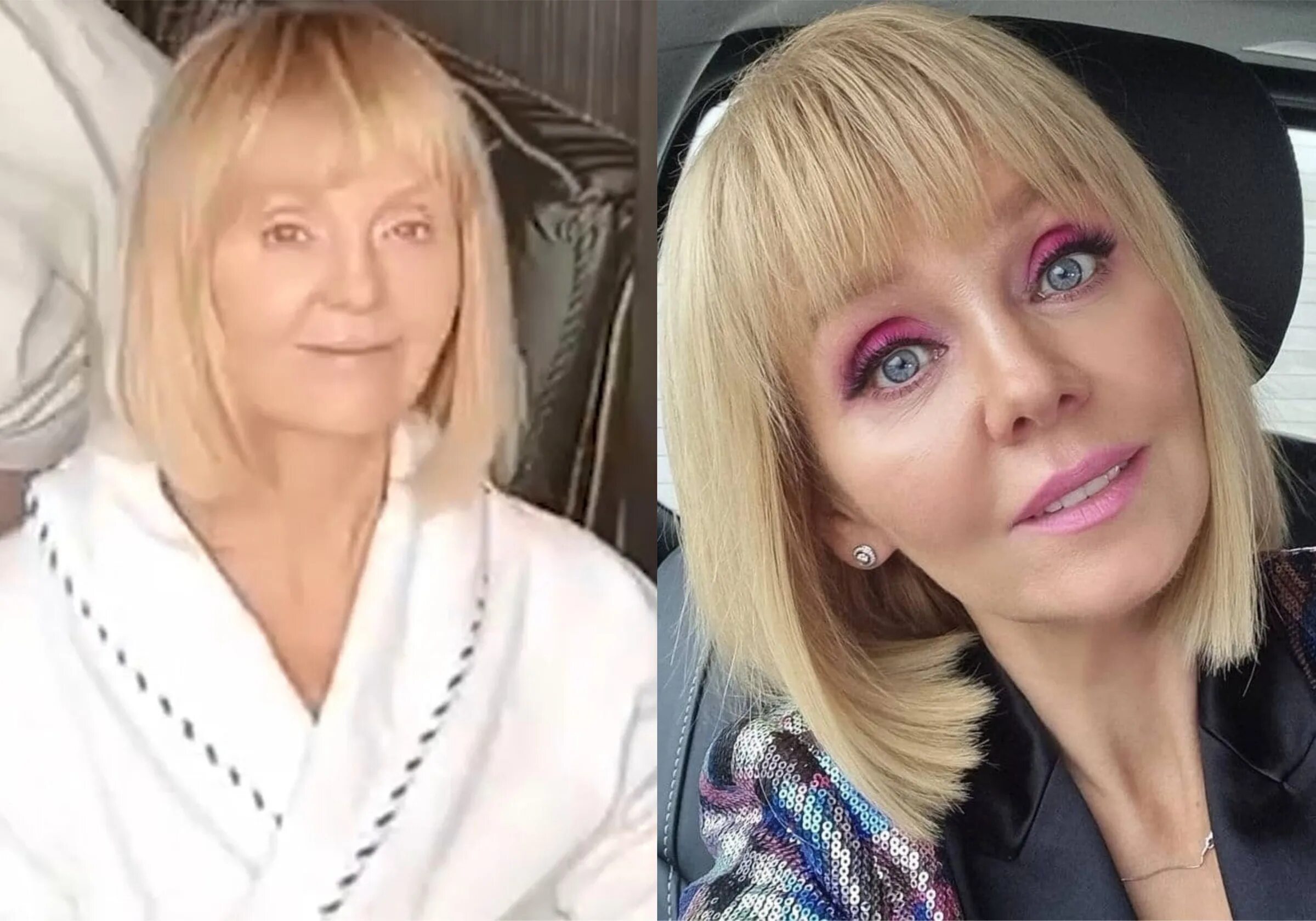 Лет без макияжа Валерия показала, как выглядит без макияжа, и настолько постаревшее лицо шокиров