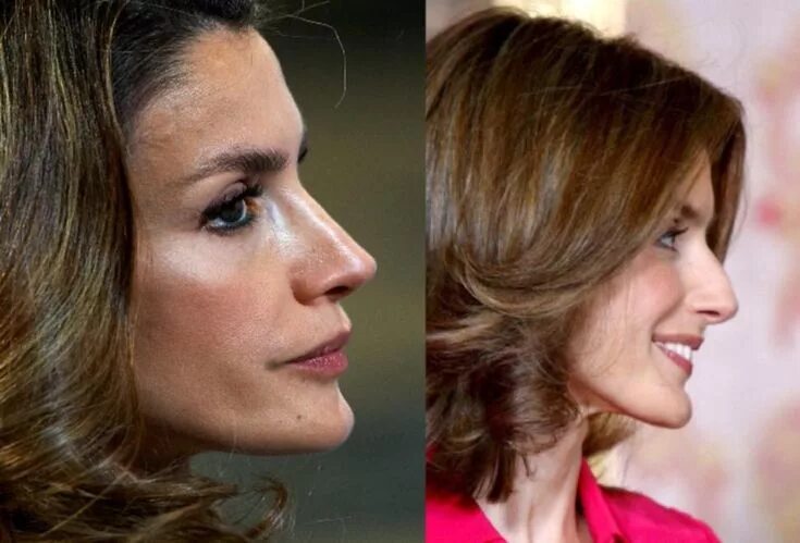 Летиция до и после пластики королева фото El oscuro pasado de la Reina Letizia de España Reina letizia, Letizia de españa,