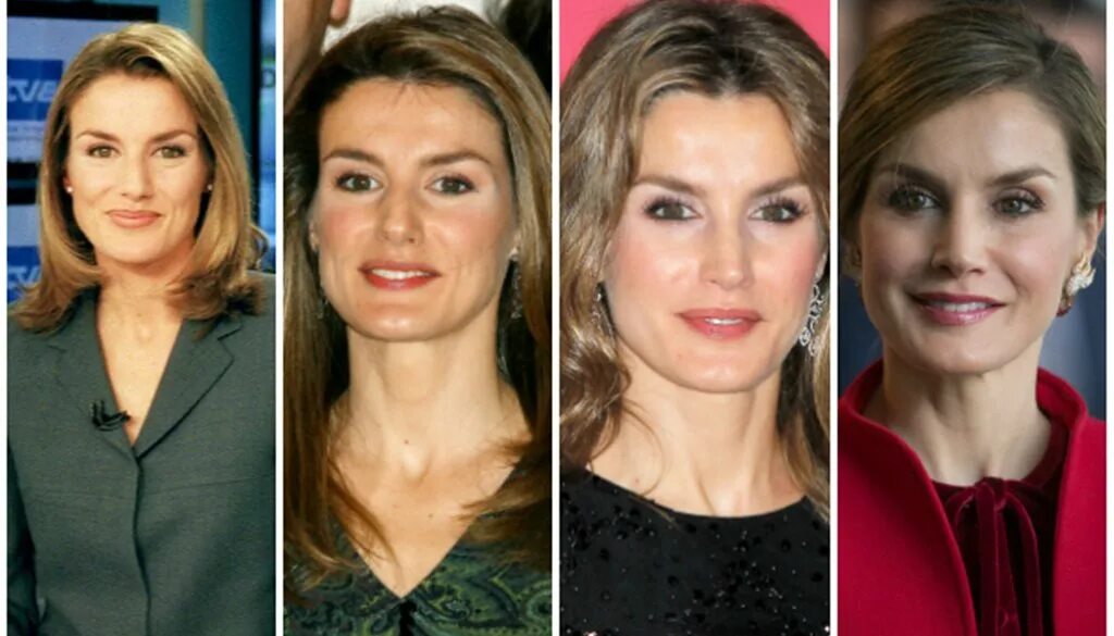 Летиция до и после пластики королева фото The Royals October However It Happened