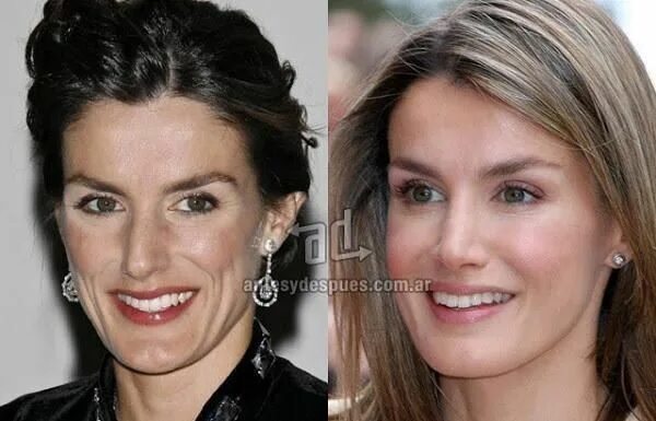 Летиция до и после пластики королева фото Pin de angeles parri en Historia Letizia de españa, Reina letizia, Leticia de es