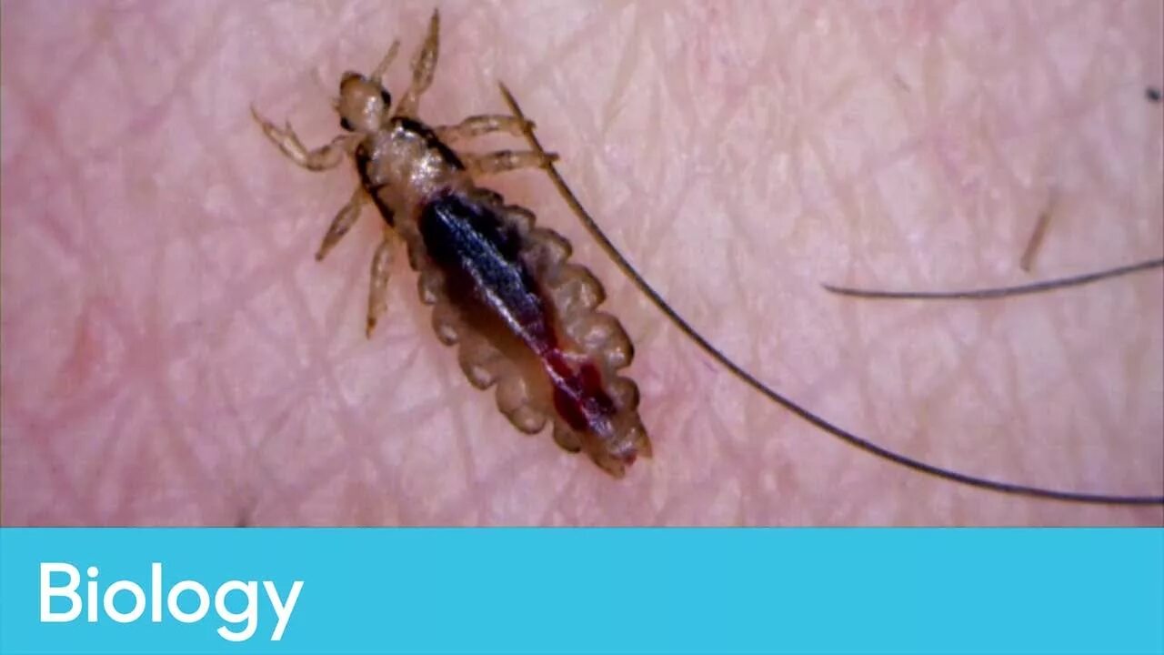 Лосиные вши укусы на человеке фото What the life-cycle of lice tells us about evolution Biology - Infested! Living 