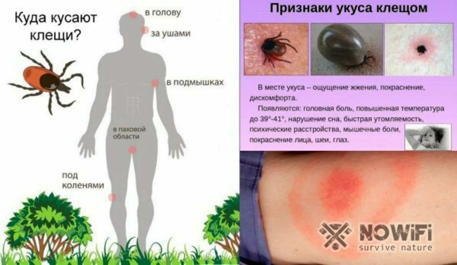 Лосиный клещ укус как выглядит Укус клеща первая симптомы