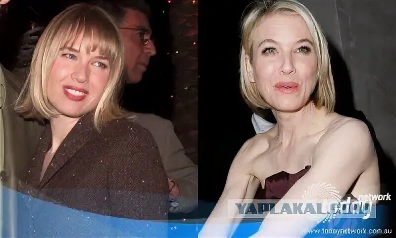 Макарская до и после пластики фото Из серии "Тогда и сейчас" - ЯПлакалъ