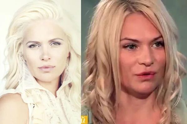 Макарская до и после пластики фото Певица Виктория Макарская до и после пластики (Фото) Умница-Красавица