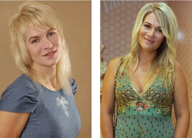 Макарская до и после пластики фото Материнство украшает: 5 звезд, которые расцвели лишь с рождением детей