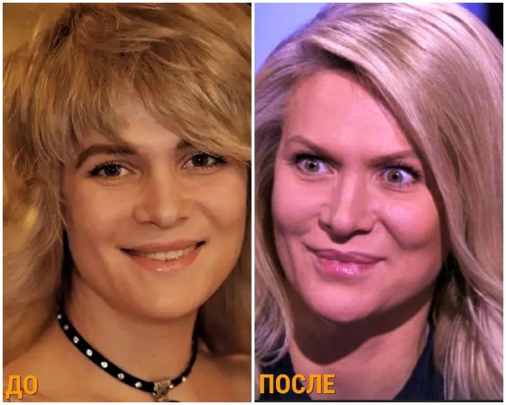 Макарская до и после пластики фото Знаменитые девушки, которые потеряли индивидуальность увеличив губы