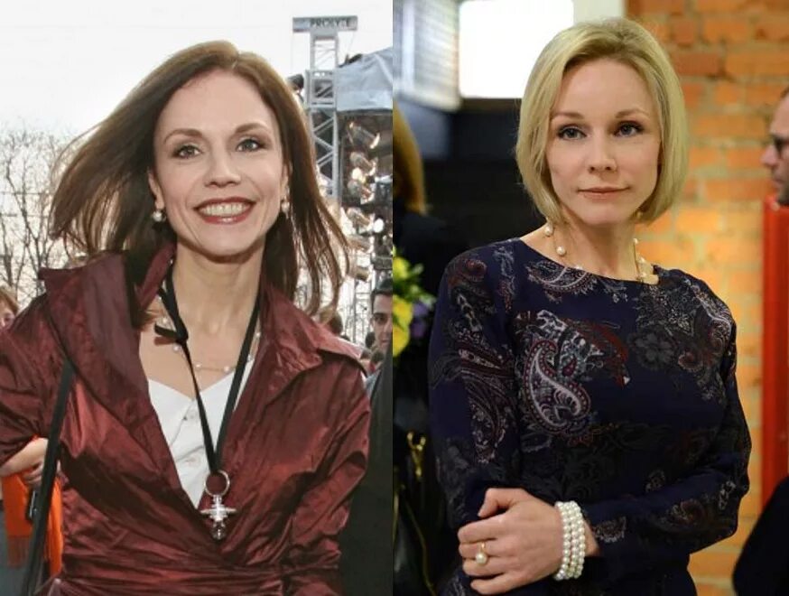 Марина зудина фото до пластики Марина Зудина до и после пластики: фото - 300 экспертов.РУ