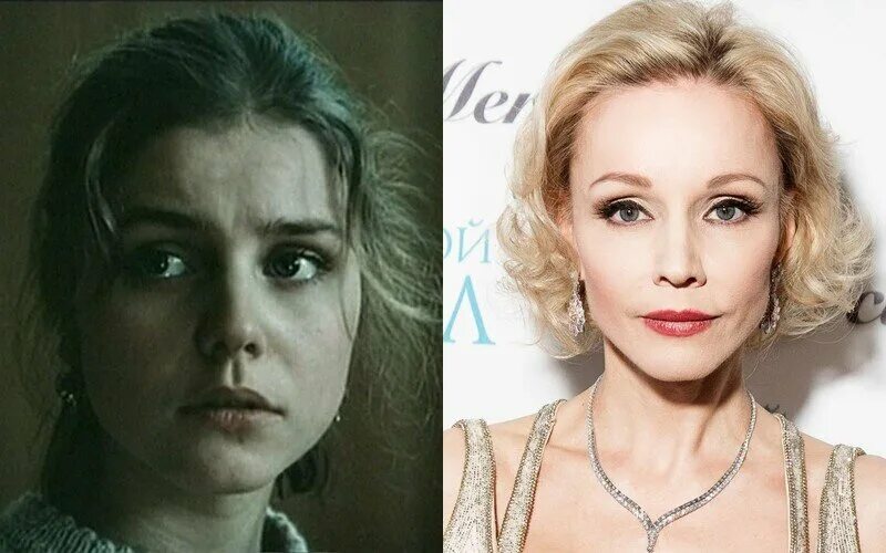 Марина зудина фото до пластики Я уколов не боюсь: 12 русских актрис, которые заморозили лица и надули губы CINE