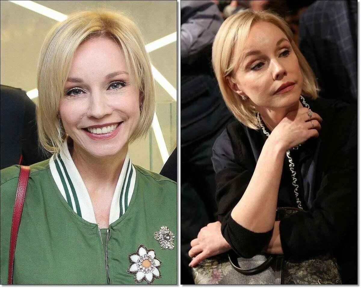 Марина зудина фото сейчас после пластики Марина Зудина До И После Пластики Фото Возраст - Karevaphoto.ru