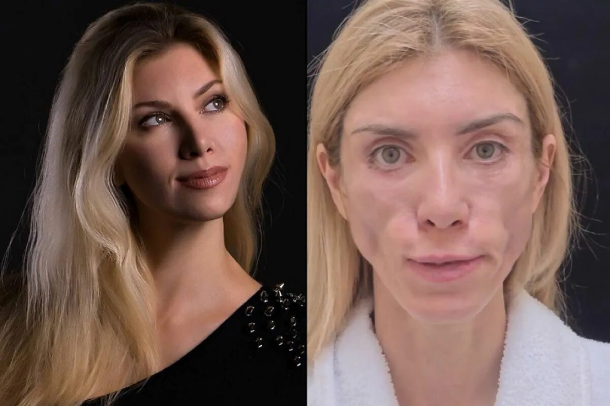 Марина зуева фото до и после пластики Интерны Франкенштейна. Хирурги превратили жизнь "Вице-миссис Россия" в ад АиФ Кр