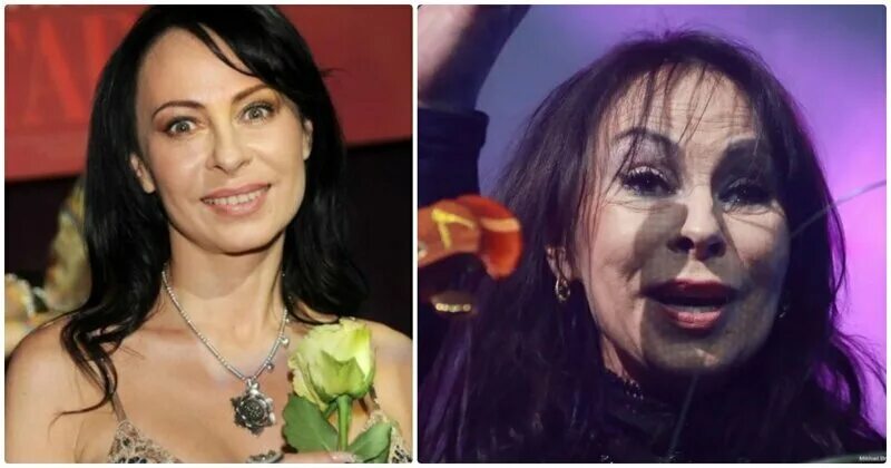 Марина зуева фото до и после пластики Изуродовали себя!: отечественные звезды - жертвы неудачной пластики