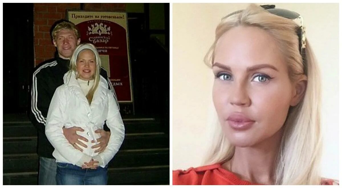 Мария до пластики фото Мария Погребняк до и после пластических операций, фото и видео