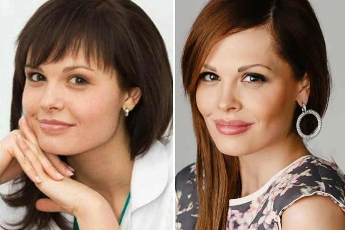 Мария горбань до и после фото Пластика ради роли в кино Современный взгляд с Давидом Гришкяном на пластическую