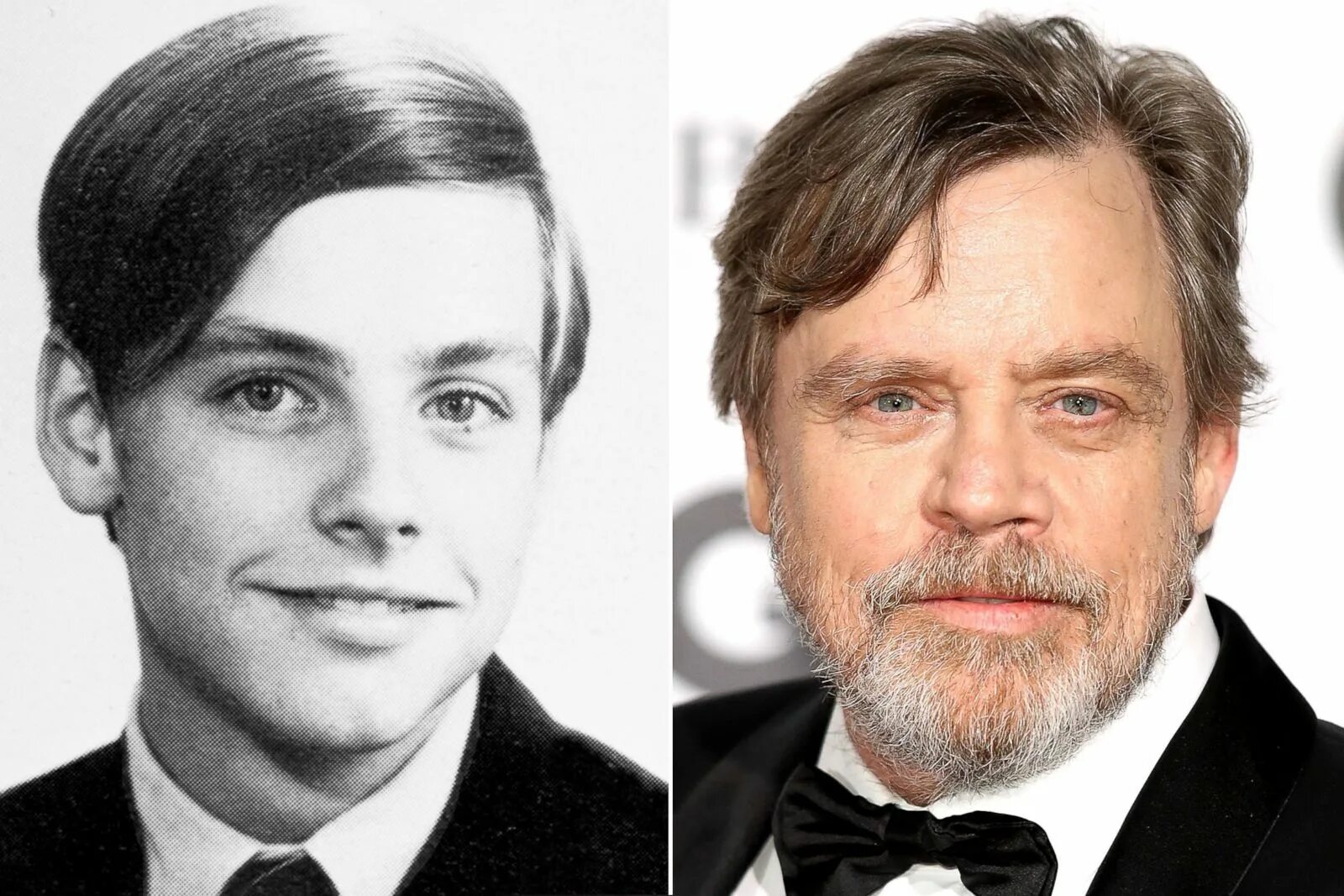 Марк хэмилл до и после аварии фото Before they were famous - ABC News