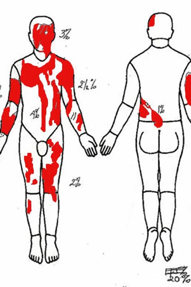 Марк ван донген фото после кислоты Listen to harrowing 999 call after acid attack victim runs into street in agony 