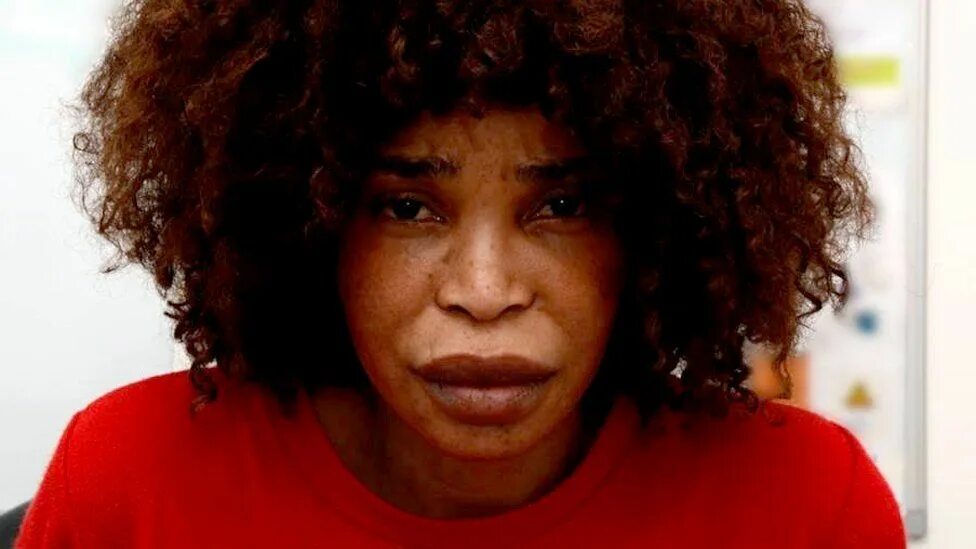 Марк ван донген фото после кислоты Mark van Dongen acid attack: Berlinah Wallace jailed - BBC News
