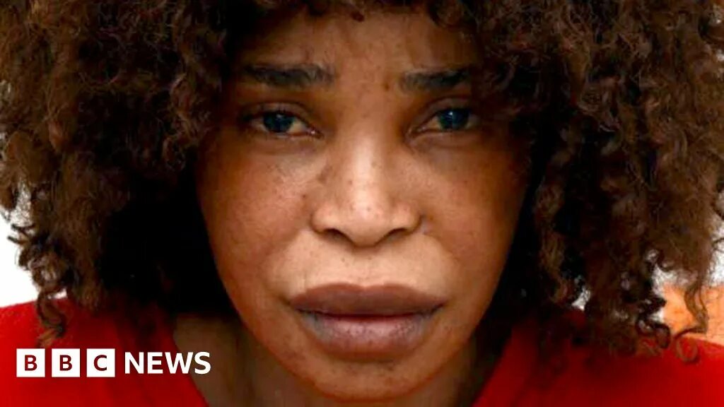 Марк ван донген фото после кислоты Mark van Dongen acid attack: Berlinah Wallace jailed - BBC News