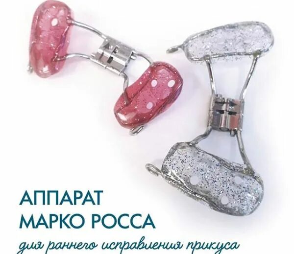Марка росса аппарат фото Как работает аппарат Марко Росса при исправлении суженной верхней челюсти