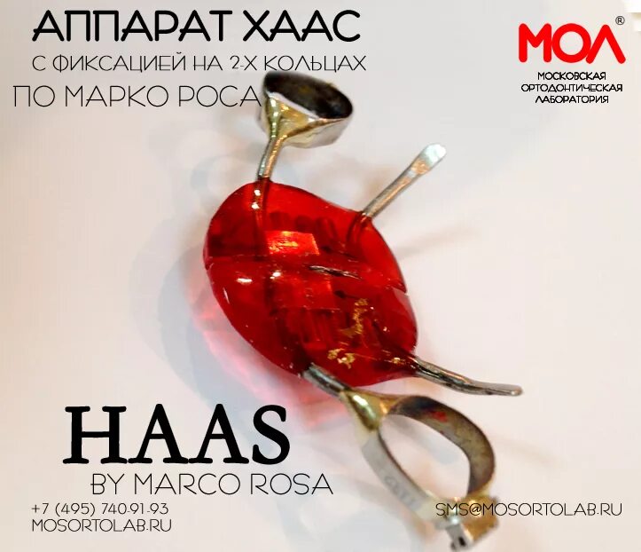 Марка росса аппарат фото Аппарат Haas by Marco Rosa, купить ортодонтический аппарат Хаас по Марку Росу с 